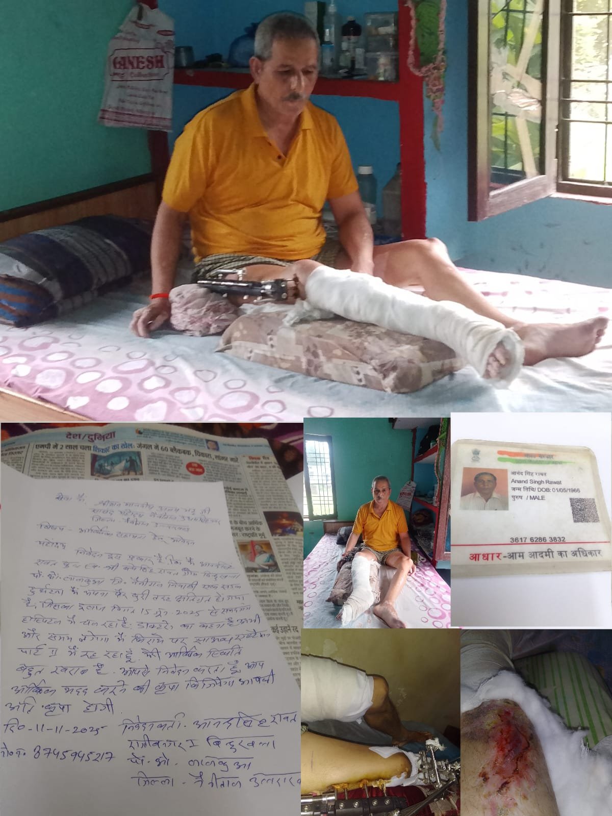 बिंदुखत्ता निवासी आर्थिक मदद की आस में आनंद सिंह रावत, विधायक-मंत्री और सांसद से गुहार के बाद भी नहीं मिली सहायता